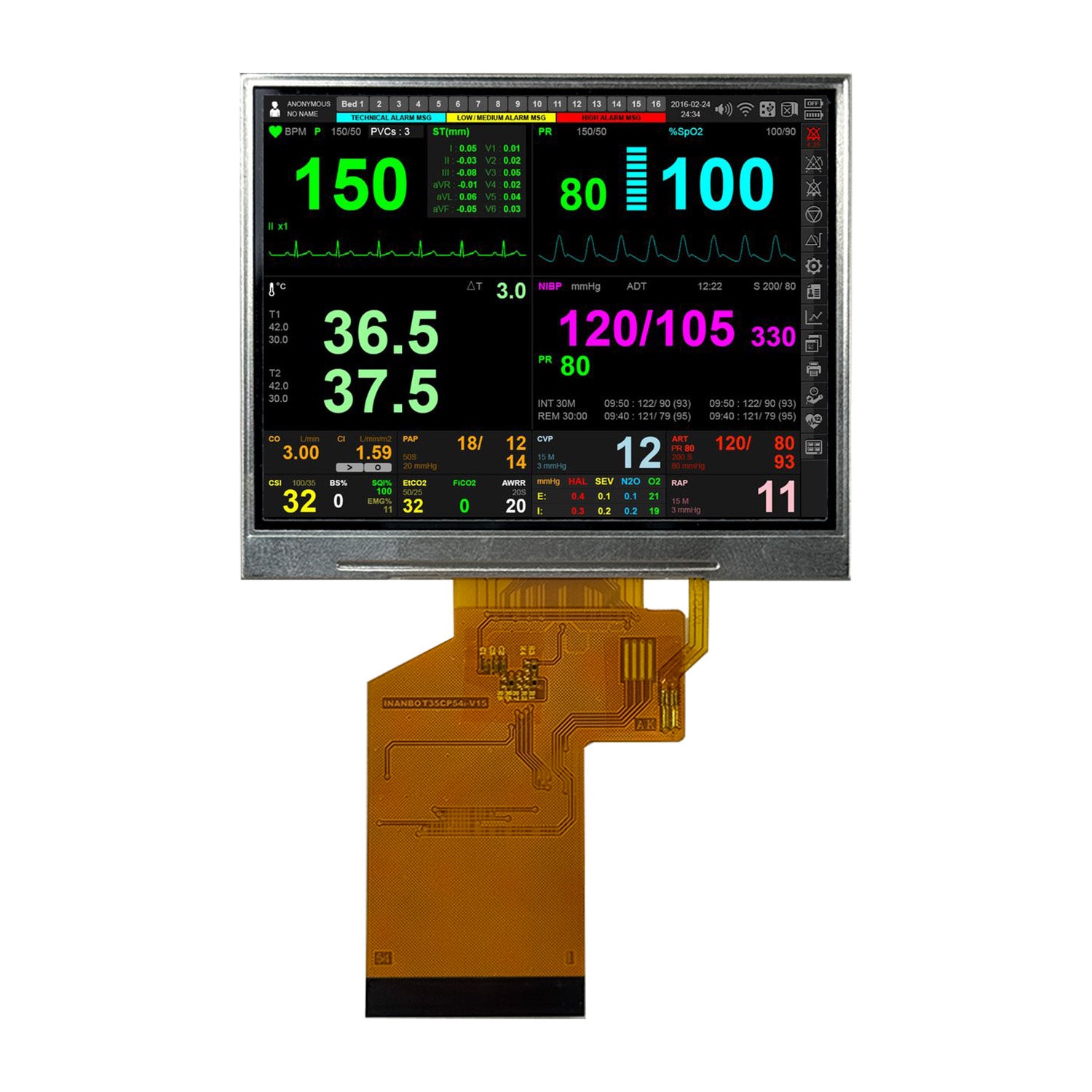 3.5-inch TFT LCD Display 320x240 RGB Interface 1000nits High Brightnes ...