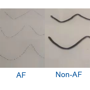 AF